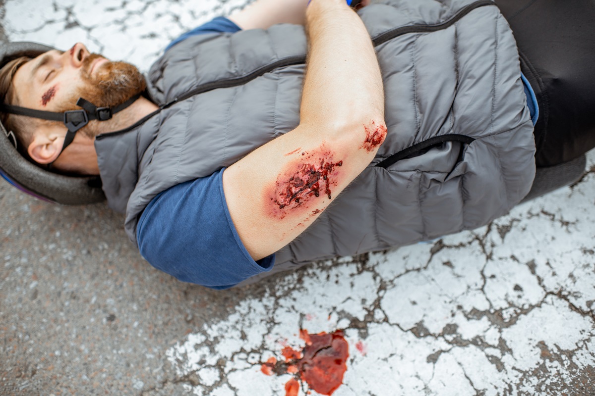 An injured cyclist on the road after an accident